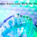 Cool color ideas for braces